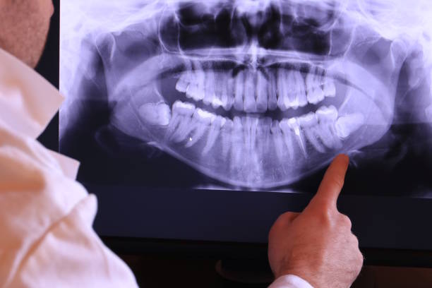 Best Emergency Denture Repair in Richmond Heights, FL